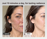 Artemis II Aër LED Light Therapy Mask